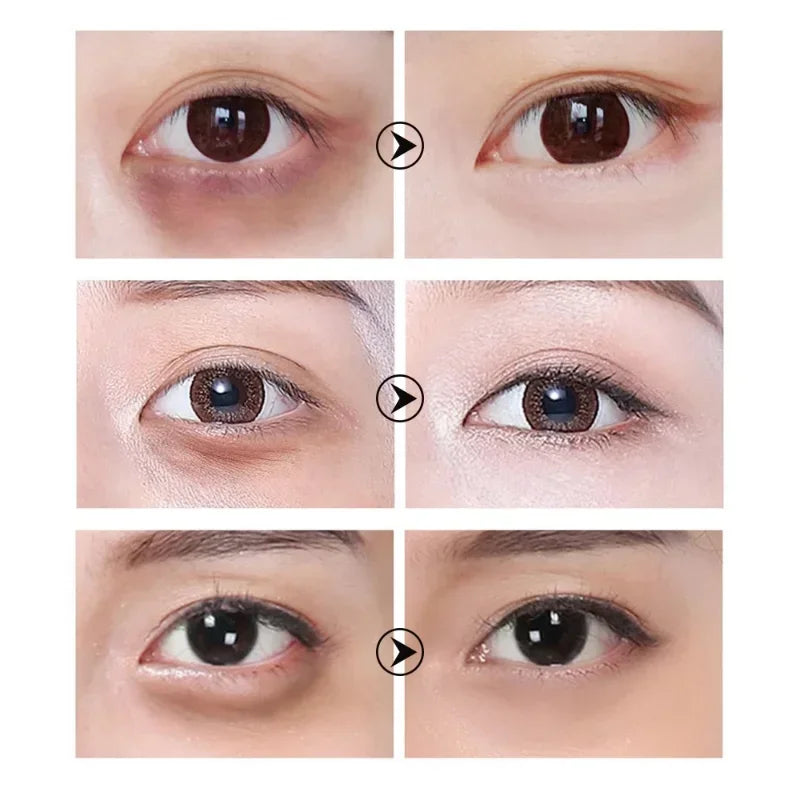 LANBENA™ Patchs au Collagène naturel anti-cernes et anti-fatigue oculaire